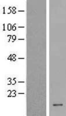 Western Blot: HCFC1R1 Overexpression Lysate [NBP2-08973]