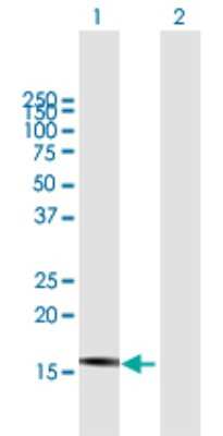 Western Blot: HCG3 Antibody [H00414061-B01P]