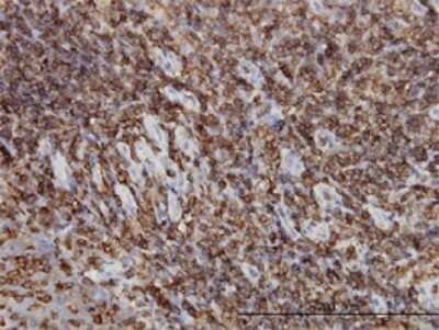 Immunohistochemistry-Paraffin: HCLS1 Antibody (1A8) [H00003059-M02]