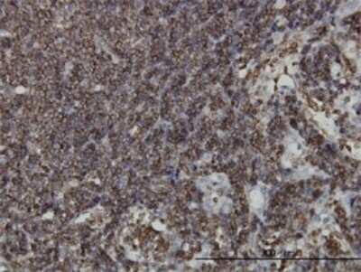 Immunohistochemistry-Paraffin: HCLS1 Antibody (2A6) [H00003059-M03]