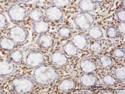Immunohistochemistry-Paraffin: HCLS1 Antibody (3F4) [H00003059-M04]