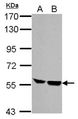 Western Blot: HCLS1 Antibody [NBP1-30953]
