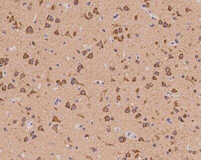 Immunohistochemistry-Paraffin: HCN1 Antibody [NBP3-12563]