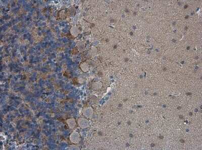 Immunohistochemistry-Paraffin: HCN1 Antibody [NBP3-13014]