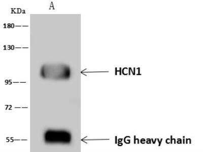 Immunoprecipitation: HCN1 Antibody [NBP3-12563]