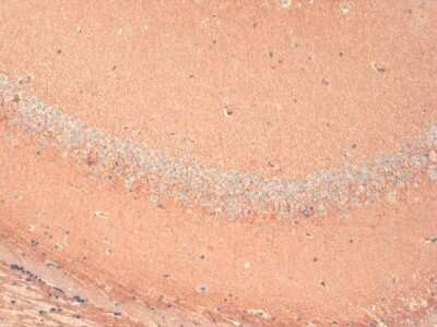 Immunohistochemistry: HCN1 Antibody (S70) [NBP1-22450]