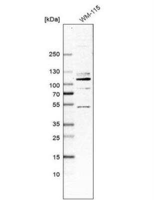 Western Blot: HCN1 Antibody [NBP2-14084]