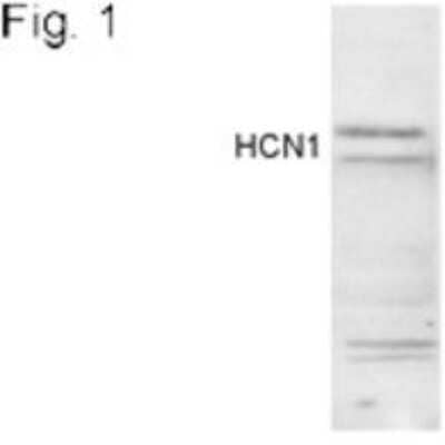 Western Blot: HCN1 Antibody [NBP2-22517]