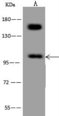 Western Blot: HCN1 Antibody [NBP3-12563]