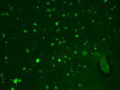 Immunocytochemistry/ Immunofluorescence: HCN2 Antibody (S71-37) [NBP2-12895]