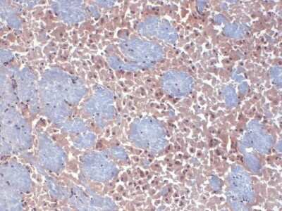 Immunohistochemistry: HCN2 Antibody (S71-37) [NBP2-12895]