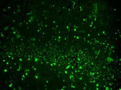 Immunohistochemistry: HCN2 Antibody (S71-37) [NBP2-12895]