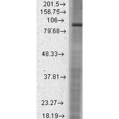 Western Blot: HCN2 Antibody (S71-37) [NBP2-12895]