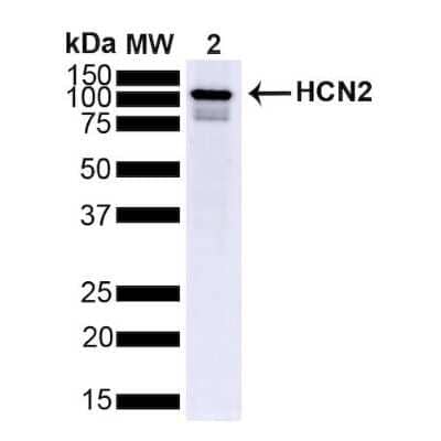 Western Blot: HCN2 Antibody (S71-37) [NBP2-12895]