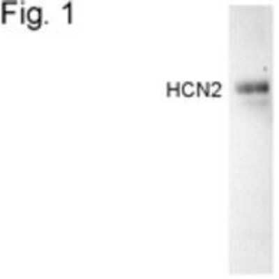 Western Blot: HCN2 Antibody [NBP2-22518]