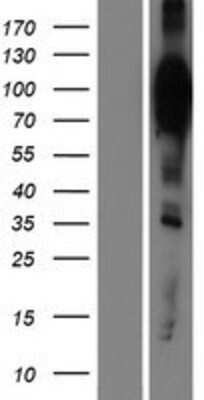 Western Blot: HCN2 Overexpression Lysate [NBP2-08224]