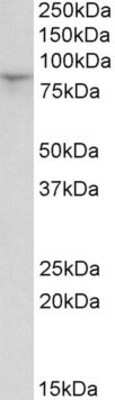 Western Blot: HCN3 Antibody [NBP1-68869]