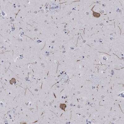 Immunohistochemistry-Paraffin: HCN4 Antibody [NBP3-17864]