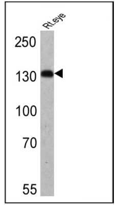 Western Blot: HCN4 Antibody (SHG 1E5) [NB100-74439]