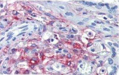 Immunohistochemistry-Paraffin: HCP1 Antibody [NBP1-06603]