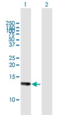 Western Blot: HCP5 Antibody [H00010866-B01P]