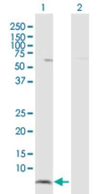 Western Blot: HCP5 Antibody [H00010866-D01P]