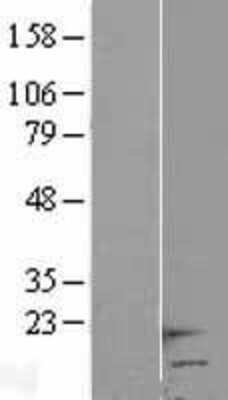 Western Blot: HCP5 Overexpression Lysate [NBL1-11472]