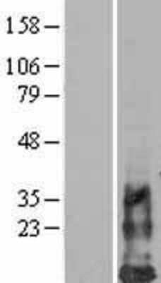 Western Blot: DAP10/HCST Overexpression Lysate [NBL1-11475]