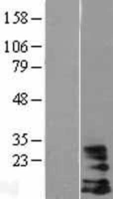 Western Blot: DAP10/HCST Overexpression Lysate [NBL1-11476]