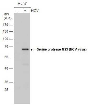 Western Blot: HCV-NS3 Antibody [NBP3-13009]