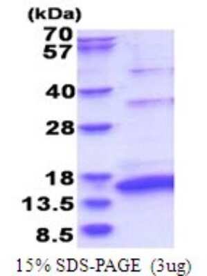 SDS-PAGE: Recombinant HCV-NS5a His Protein [NBP2-51751]