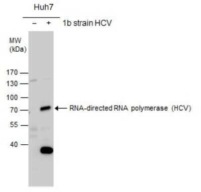 Western Blot: HCV-NS5b Antibody [NBP3-13011]