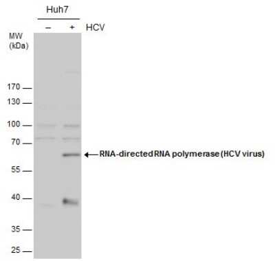 Western Blot: HCV-NS5b Antibody [NBP3-13012]