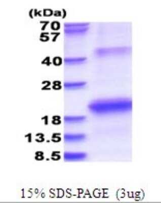 SDS-PAGE: Recombinant HCV-NS5b His Protein [NBP2-51689]