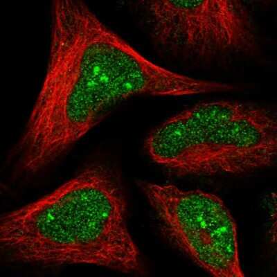 Immunocytochemistry/ Immunofluorescence: HD domain containing 2 Antibody [NBP1-88251]