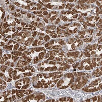 Immunohistochemistry-Paraffin: HD domain containing 2 Antibody [NBP1-88251]