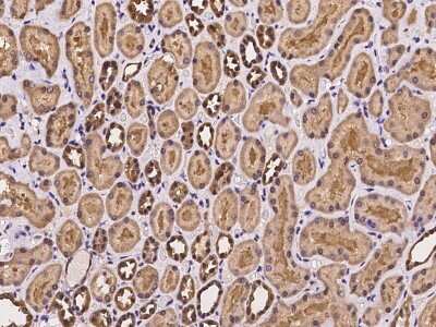 Immunohistochemistry-Paraffin: HD domain containing 2 Antibody [NBP2-97983]