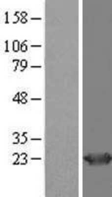 Western Blot: HD domain containing 2 Overexpression Lysate [NBL1-11487]