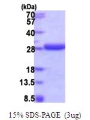 SDS-PAGE: Recombinant Human HD domain containing 2 His Protein [NBP2-51905]