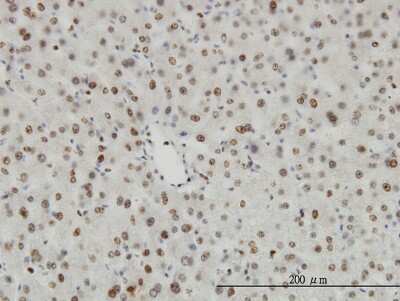 Immunohistochemistry-Paraffin: HDAC1 Antibody (1D6) [H00003065-M06]