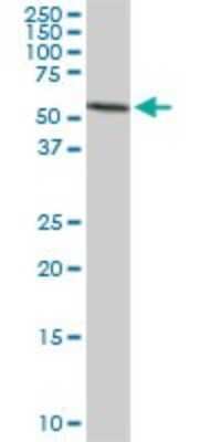 Western Blot: HDAC1 Antibody (1D6) [H00003065-M06]