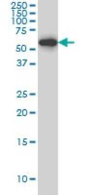 Western Blot: HDAC1 Antibody (1D6) [H00003065-M06]