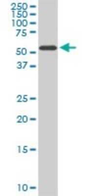 Western Blot: HDAC1 Antibody (1D6) [H00003065-M06]