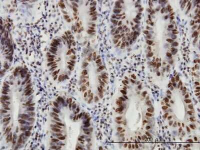 Immunohistochemistry-Paraffin: HDAC1 Antibody (5C11) [H00003065-M14]