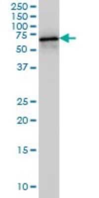 Western Blot: HDAC1 Antibody (5C11) [H00003065-M14]