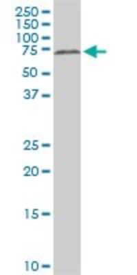 Western Blot: HDAC1 Antibody (5C11) [H00003065-M14]