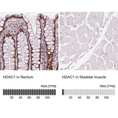 Immunohistochemistry-Paraffin: HDAC1 Antibody (CL0510) [NBP2-52937]