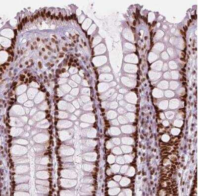 Immunohistochemistry-Paraffin: HDAC1 Antibody (CL0510) [NBP2-52937]