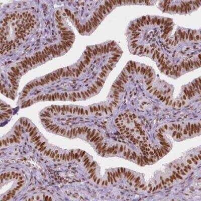 Immunohistochemistry-Paraffin: HDAC1 Antibody (CL0510) [NBP2-52937]