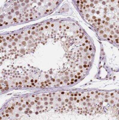 Immunohistochemistry-Paraffin: HDAC1 Antibody (CL0510) [NBP2-52937]